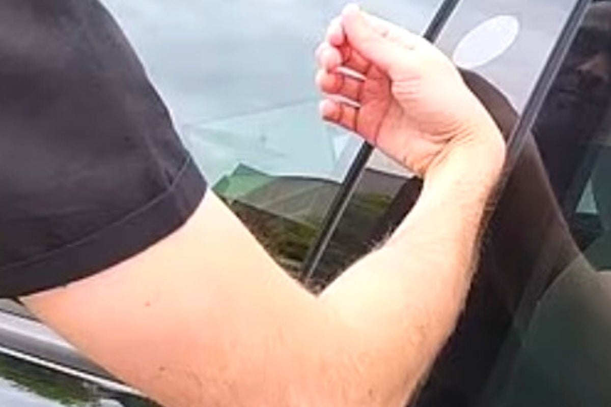 Why This Tesla Driver Paid $400 To Implant Car Key Into His Right Hand: 'It Comes In Handy'
