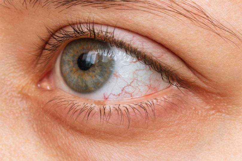 OKYO Pharma Files US IND Application For Dry Eye Disease Candidate - OKYO Pharma (NASDAQ:OKYO)
